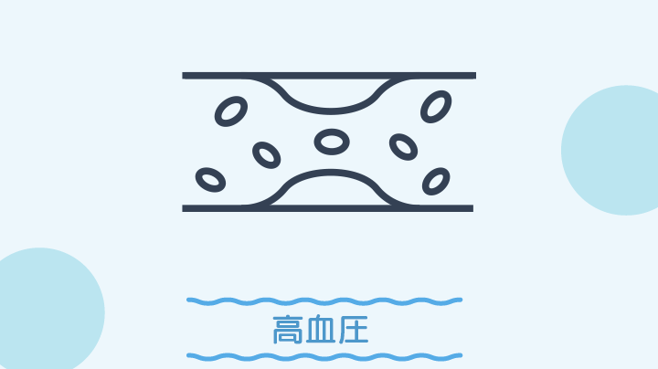 高血圧